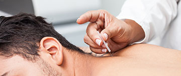 Acupuncture : par qui et à quelles conditions - MACSF