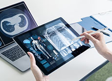 Téléradiologie, attention à ne pas oublier le tableau clinique - MACSF