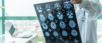 un médecin consulte une irm cerebral | MACSF