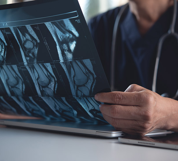 Médecin tenant et regardant le résultat d'un scanner - MACSF