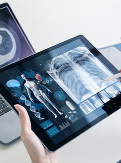 Téléradiologie, attention à ne pas oublier le tableau clinique - MACSF
