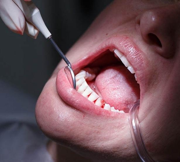 soins dentaires