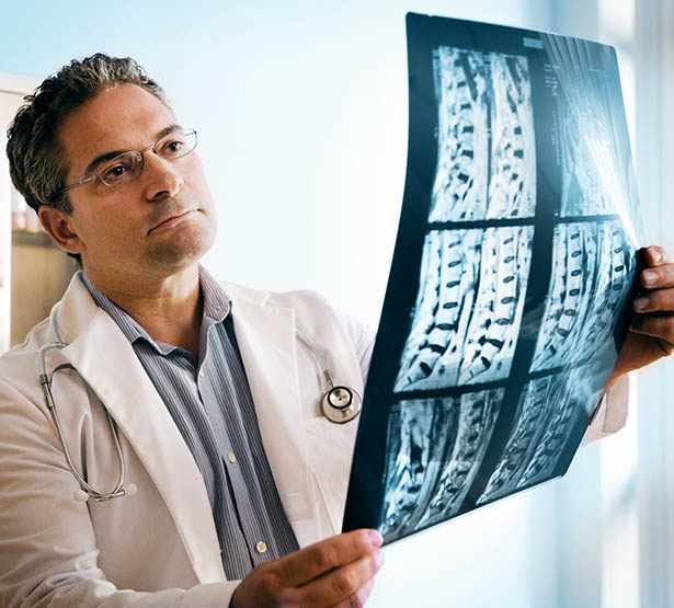 Un médecin observe une radio du rachis - MACSF