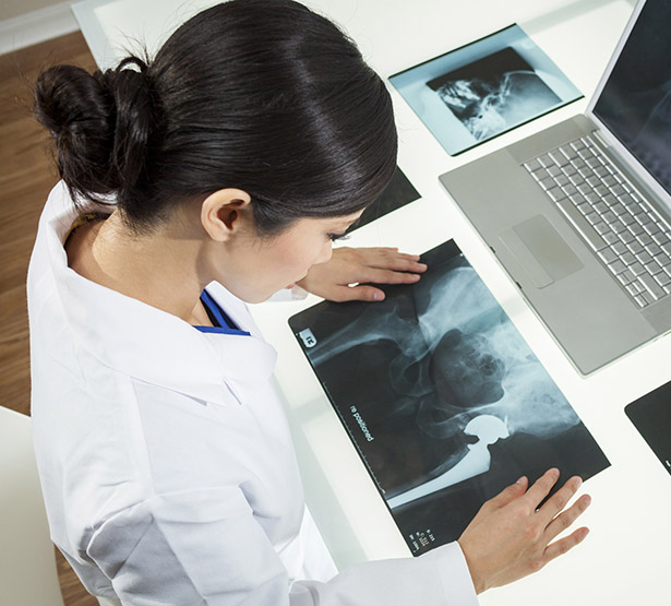 Une femme médecin étudie une radiographie de hanche - MACSF