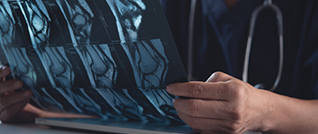 Médecin tenant et regardant le résultat d'un scanner - MACSF