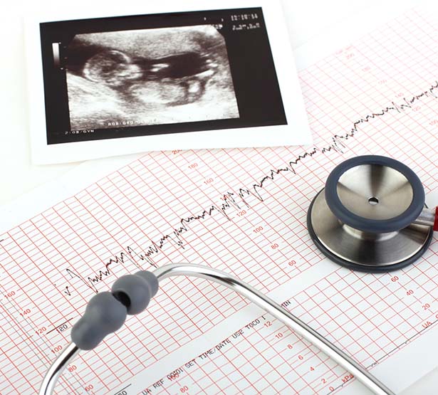 Echographie, tracé monitoring et stéthoscope posé sur un bureau - MACSF