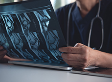 Médecin tenant et regardant le résultat d'un scanner - MACSF