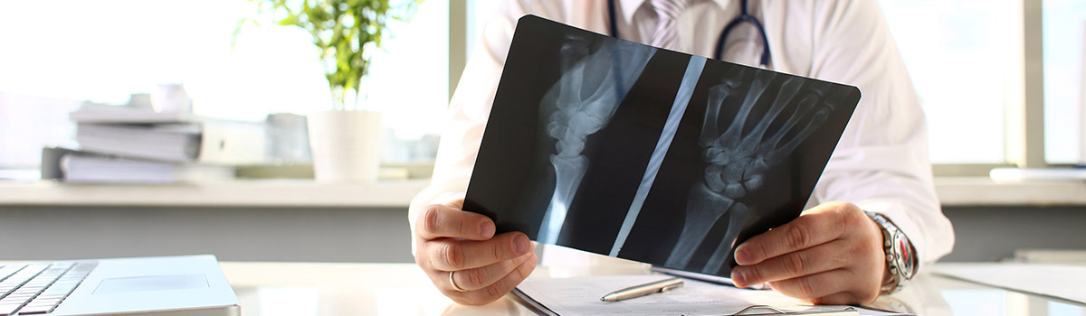 Un radiologue consulte un cliché - MACSF