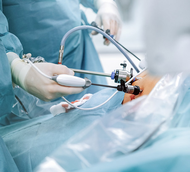 Intervention en chirurgie digestive - MACSF