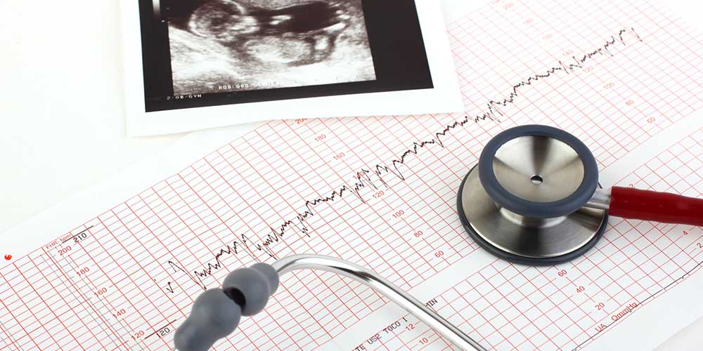 naissance enfant etat de mort apparente sage femme condamnee penalement