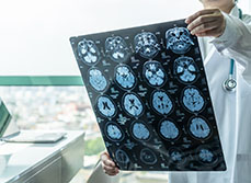 un médecin consulte une irm cerebral | MACSF