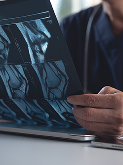 Médecin tenant et regardant le résultat d'un scanner - MACSF