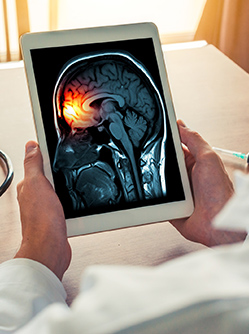 Méningite : une urgence médicale rare mais toujours possible en médecine de ville | MACSF