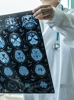 un médecin consulte une irm cerebral | MACSF