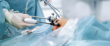 Intervention en chirurgie digestive - MACSF