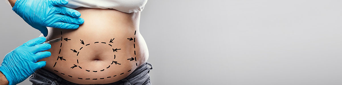 Chirurgie plastique et esthétique