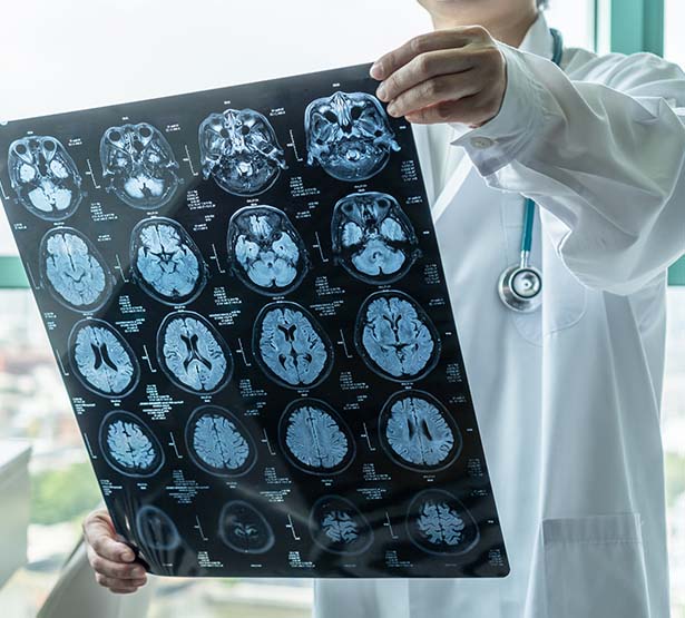 un médecin consulte une irm cerebral | MACSF