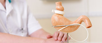 Ablation des anneaux de gastroplastie MACSF