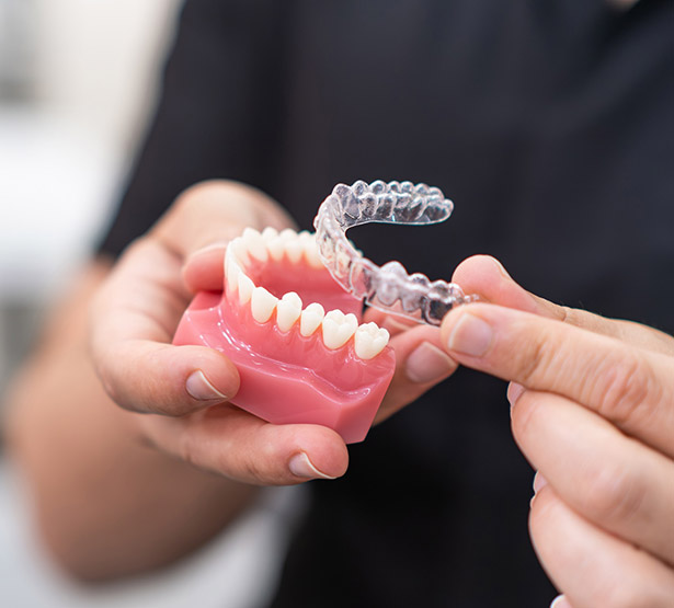 Un orthodontiste présente un moulage de mâchoire et une gouttière dentaire - MACSF