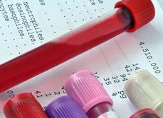 Transmission des résultats d'analyses de biologie médicale MACSF