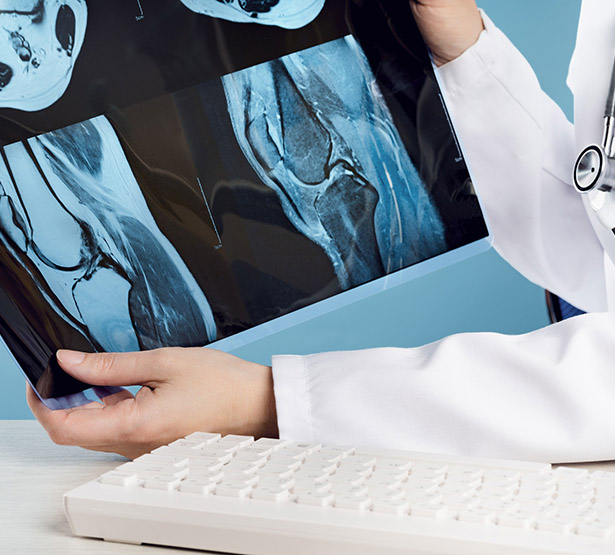 Un médecin observe une radiographie du genou - MACSF