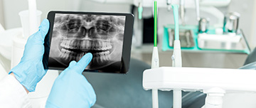 Un chirurgien-dentiste montre une radio panoramique sur sa tablette - MACSF