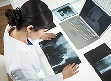 Une femme médecin étudie une radiographie de hanche - MACSF