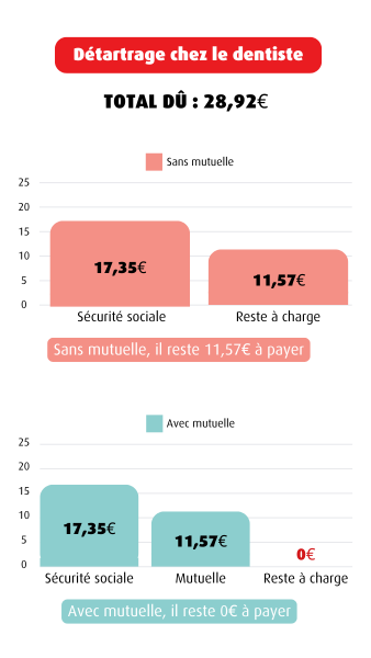 detartrage dentiste.png