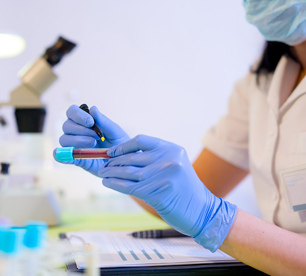 Mains gantées qui procèdent à une inscription sur un flacon de sang - MACSF