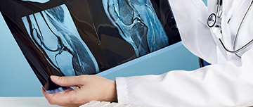 Un médecin observe une radiographie du genou - MACSF