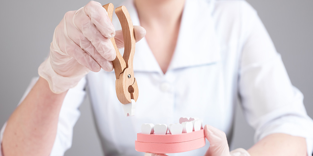 atteinte nerf lingual suite avulsion dents sagesse