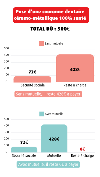 couronne dentaire.png