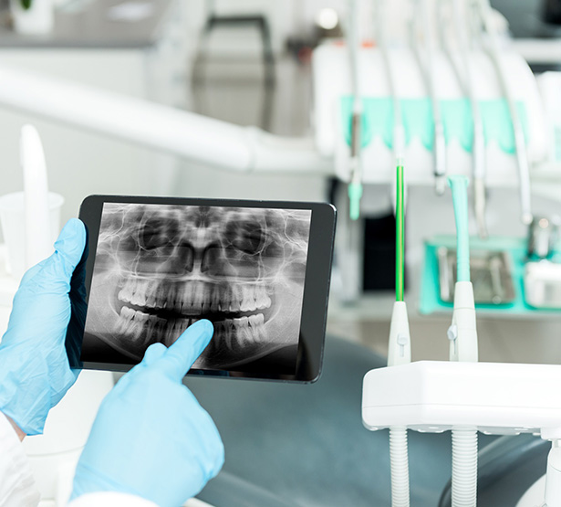 Un chirurgien-dentiste montre une radio panoramique sur sa tablette - MACSF