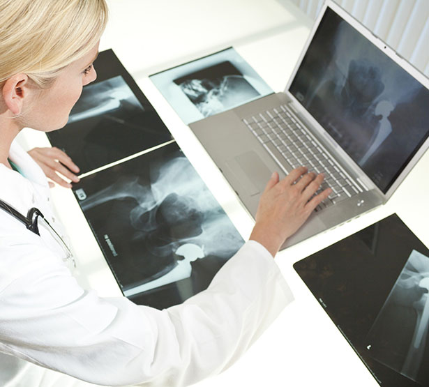 Un médecin observe des radios de la hanche | MACSF